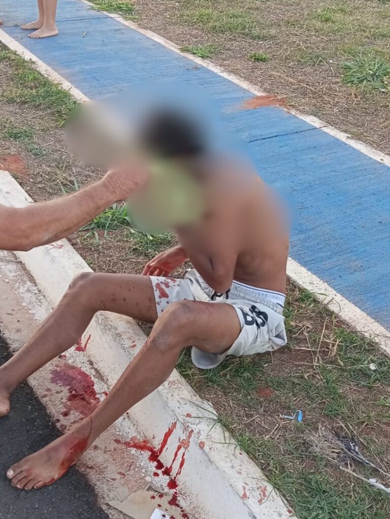 Jovem fica ferido após ser atingido por linha com cerol no bairro Vida Nova
