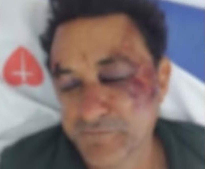 Jovem acusado de espancar garçom de 60 anos se entrega à polícia após fuga